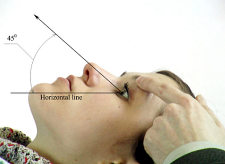 pictures: image_12 measuring IOP