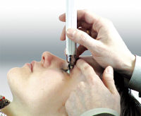 pictures: image_13 measuring IOP with tonometer diaton