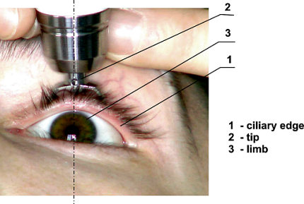 pictures: image_14 tonometer diaton - manual