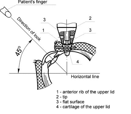 pictures: image_15 measuring IOP with diaton - scheme